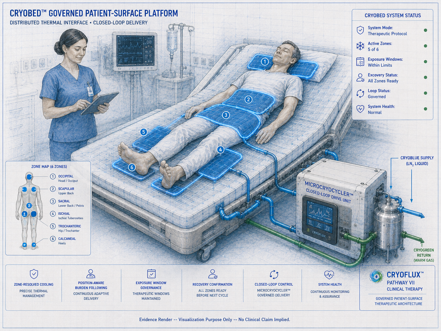 CryoBed governed patient-surface platform -- six numbered anatomical zones glowing CryoBlue on CryoMattress. MicroCryoCycler closed-loop drive unit with CryoBlue supply and CryoGreen return labeled. Clinical nurse with tablet. Zone map with six zones: Occipital, Scapular, Sacral, Ischial, Trochanteric, Calcaneal. Status panel: System Mode Therapeutic Protocol, Active Zones 5 of 6, Exposure Windows Within Limits, Recovery Status All Zones Ready, Loop Status Governed, System Health Normal. Blueprint watercolor doctrine. Evidence render -- visualization purpose only -- no clinical claim implied.